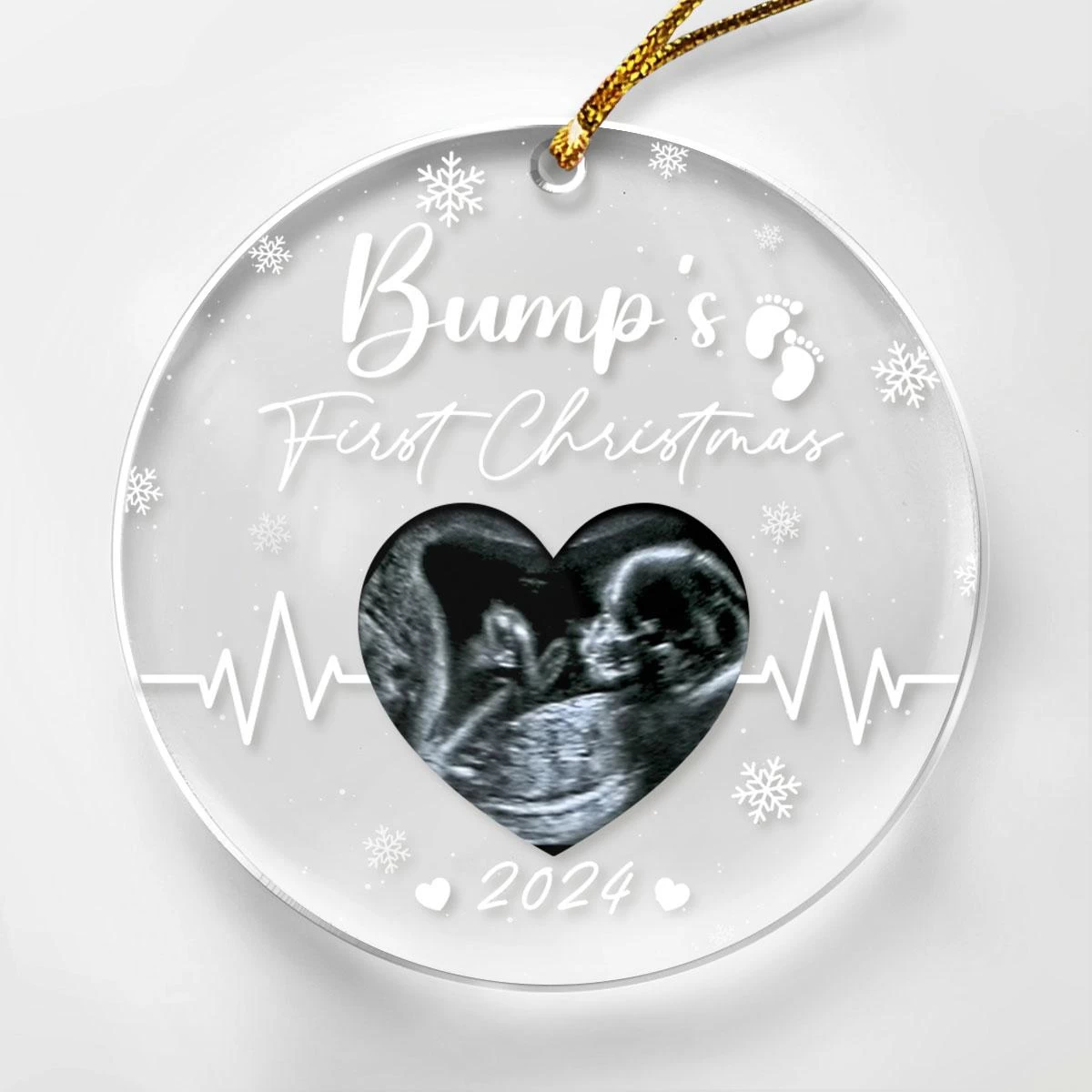 Personalized Bumps First Christmas Ornaments Sonogram Ultrasound Pregnancy Announcement Acrylic Ornament Gift 3 Personalized Bumps First Christmas Ornaments Sonogram Ultrasound Pregnancy Announcement Acrylic Ornament Gift