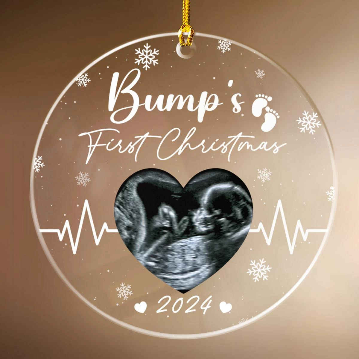 Personalized Bumps First Christmas Ornaments Sonogram Ultrasound Pregnancy Announcement Acrylic Ornament Gift 4 Personalized Bumps First Christmas Ornaments Sonogram Ultrasound Pregnancy Announcement Acrylic Ornament Gift - Image 2