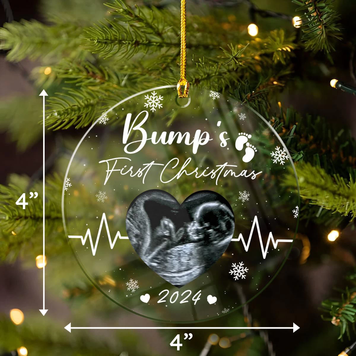 Personalized Bumps First Christmas Ornaments Sonogram Ultrasound Pregnancy Announcement Acrylic Ornament Gift 7 Personalized Bumps First Christmas Ornaments Sonogram Ultrasound Pregnancy Announcement Acrylic Ornament Gift - Image 5