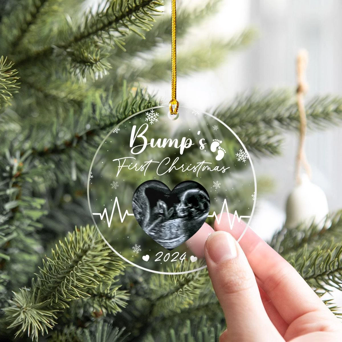 Personalized Bumps First Christmas Ornaments Sonogram Ultrasound Pregnancy Announcement Acrylic Ornament Gift 9 Personalized Bumps First Christmas Ornaments Sonogram Ultrasound Pregnancy Announcement Acrylic Ornament Gift - Image 7